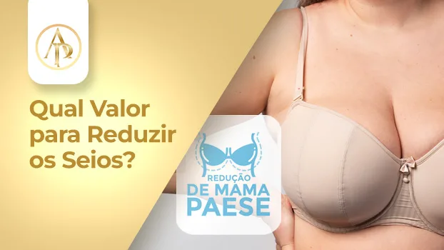 Masto Pexia mamoplastia redutora reducao de mama quanl custa a cirurgia mamaria