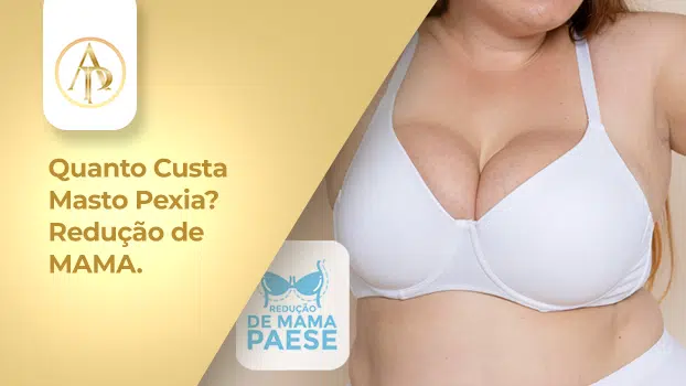 mamoplastia, masto pexia, reducao de mama, mamoplastia redutora, cirurgia para levantar a mama, redução mamária, cirurgia de redução de mama, redução de mama preço 2024,