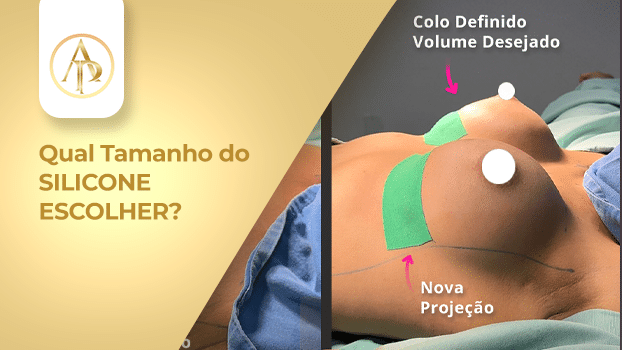 Imagem sobre escolha de silicone