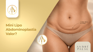 lipo abdominoplastia marabá