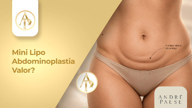Mini Lipo Abdominoplastia em Marabá: Conheça Mais