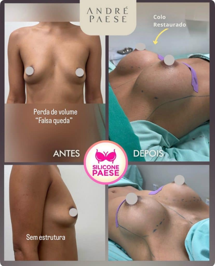 Dr André Paese Cirurgia Plástica